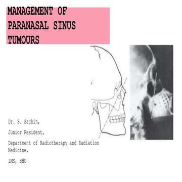 Paranasal sinus tumours - management principles
