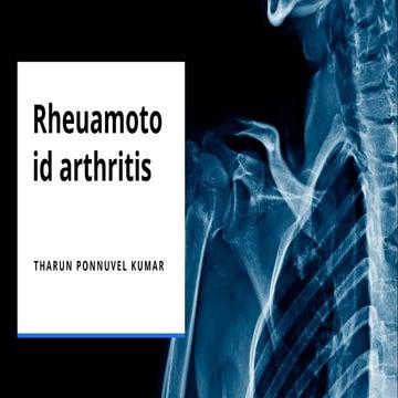 Presentation rheumatoid arthritis. . | PPTX