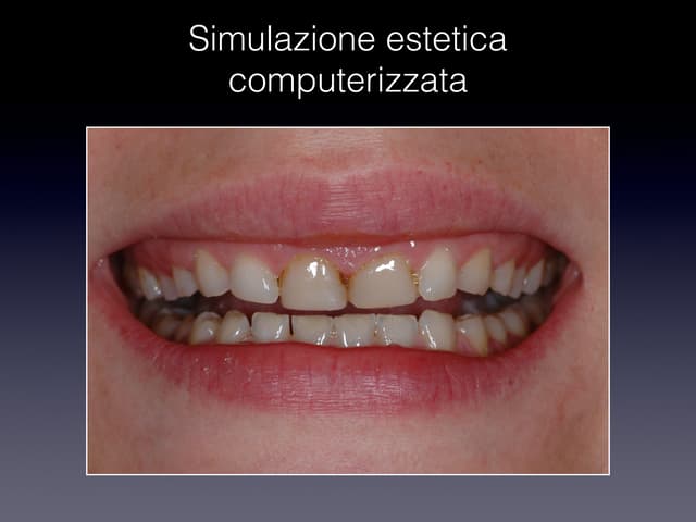 vip más agenesia dental