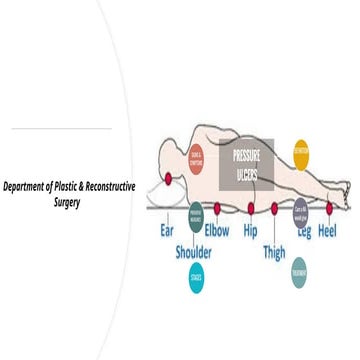 Pressure injuries - Bedsores.pptx medicine | PPTX