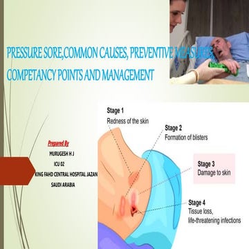 pressure sore ,causes ppt murugesh.pptx