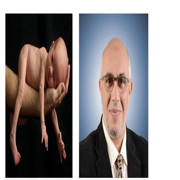 Preterm labor an update