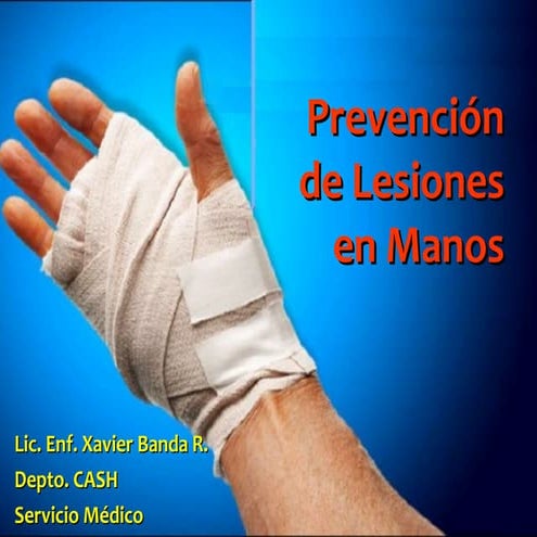 Preventing hand injuries 2