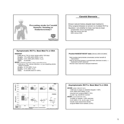 Preventing Stroke in Carotid Stenosis