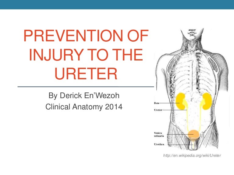 Prevention of Ureteral Injury 2014 En'wezoh
