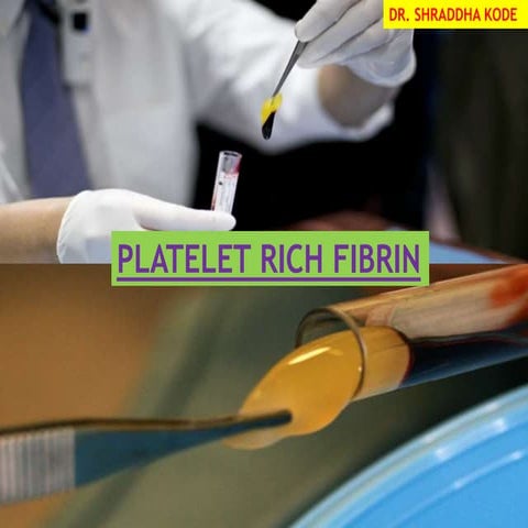 PLATELET RICH FIBRIN - ROLE IN PERIODONTICS | PPTX