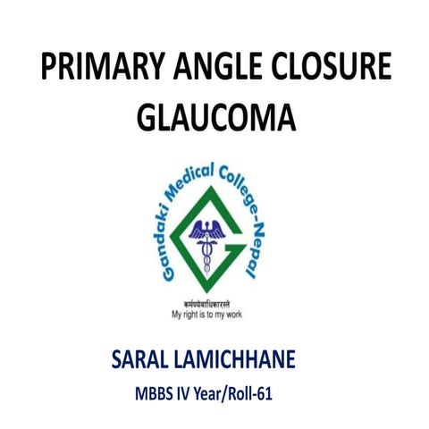 Primary Angle Closure Glaucoma- Saral