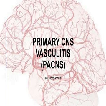 Primary cns vasculitis