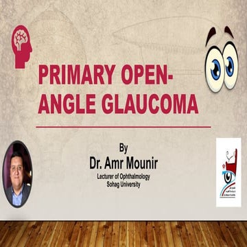 Primary open angle glaucoma | PPTX