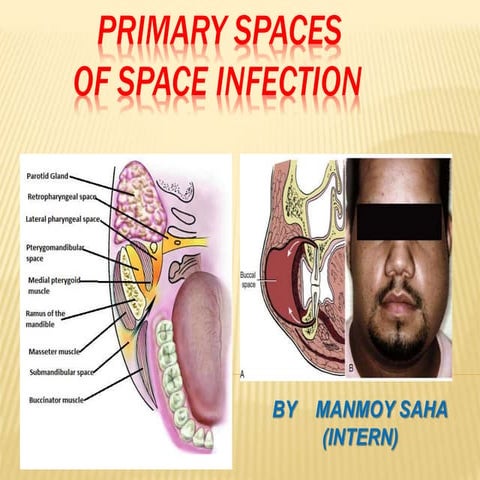 Primary spaces of space infection