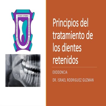 Principios del tratamiento de los dientes retenidos