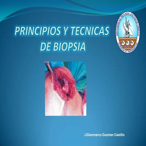 Principios y tecnicas_de_biopsia (Gianmarco Guzman Castillo)