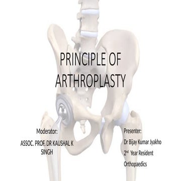 Rotationplasty | PPTX