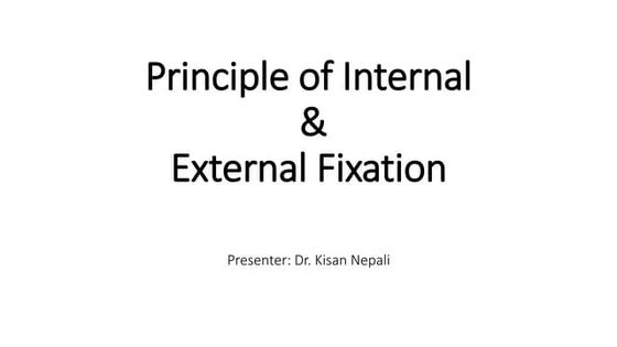 AO Principles of Fracture treatment & Different Implants. | PPT