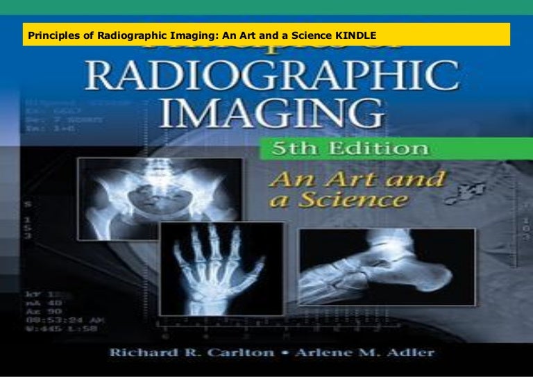 Principles of Radiographic Imaging An Art and a Science KINDLE