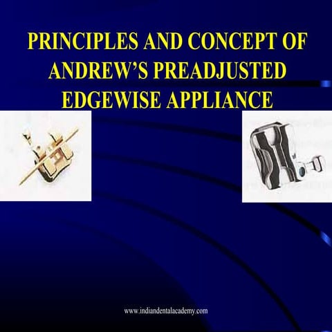 Principles and concept of andrew’s preadjusted edgewise appliance /certified ...