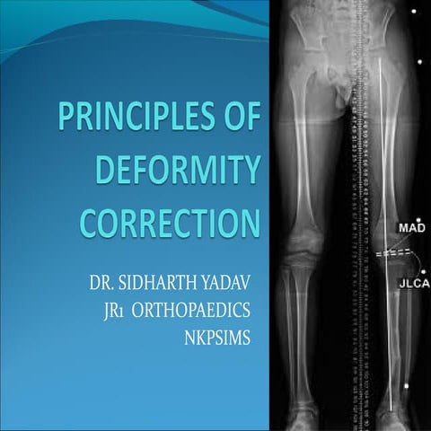 Principles of deformity correction
