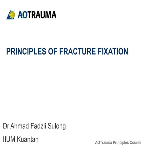 Principles of fracture fixation