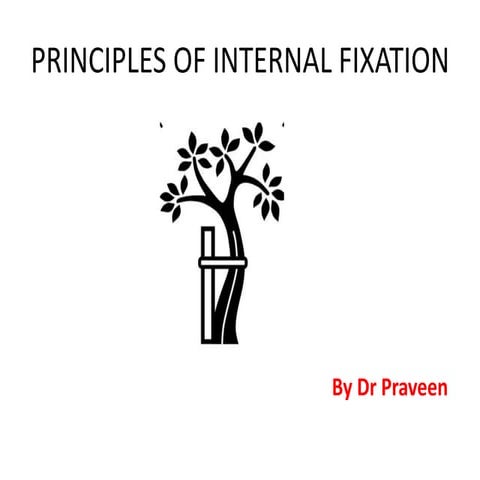 Principles of internal fixation