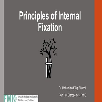 Principles of Internal Fixation.pptx