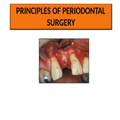 PRINCIPLES OF PERIODONTAL SURGERY (1).pptx