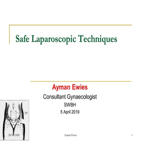 Dr Ayman Ewies - Principles of Safe Laparoscopic Entry