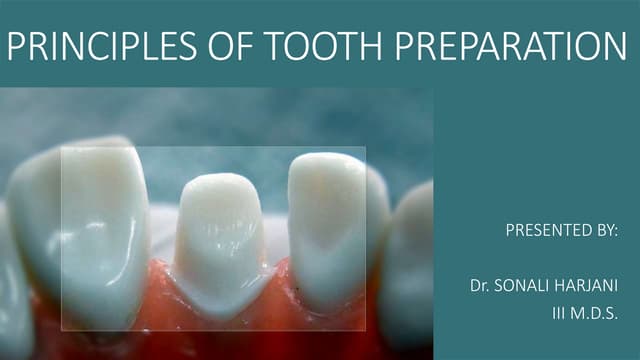 Principles of tooth preparation | PPTX