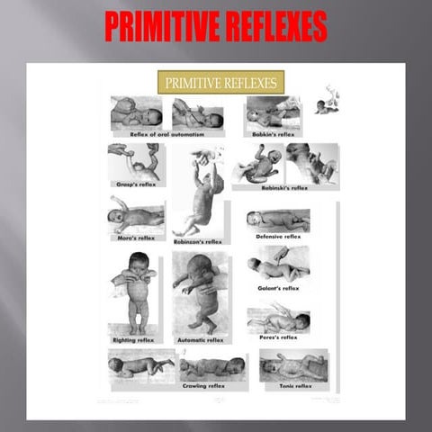 PRI REFLEXES TIPS AND TRICKS DEVELOPMENTAL.ppt