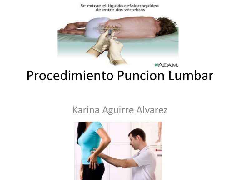 Hidrocefalia después de punción lumbar
