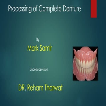 processing of complete denture in lab.pptx