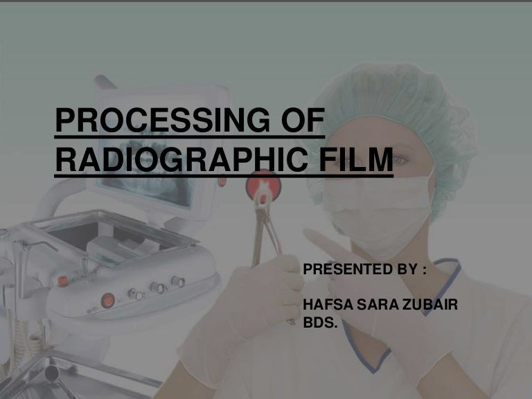 Processing of x ray film
