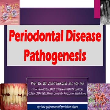  periodonta Disease pathogenesis