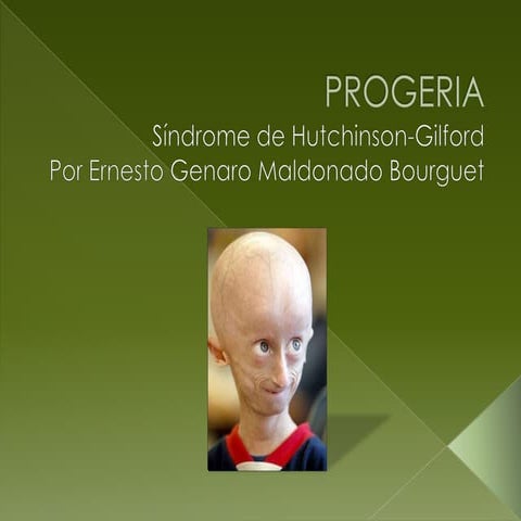 Progeria | ODP