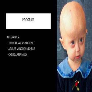 Progeria | PPT