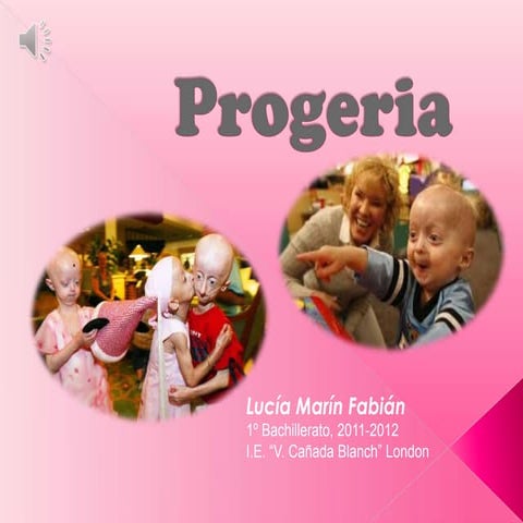 Progeria , by Lucia