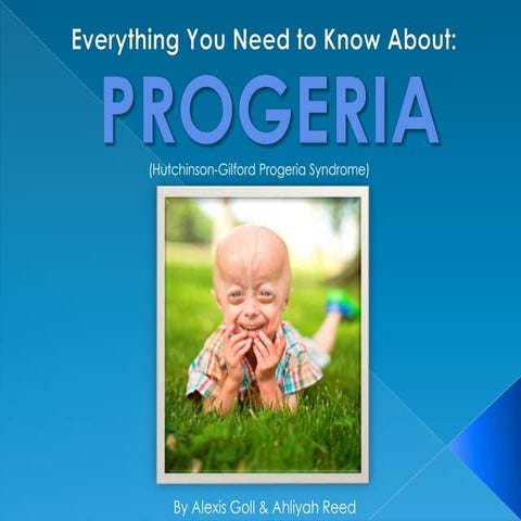 Everything you Need to Know About Progeria