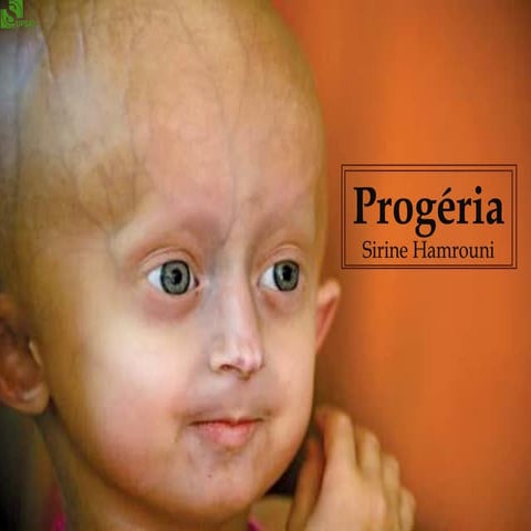 Progeria | PPT