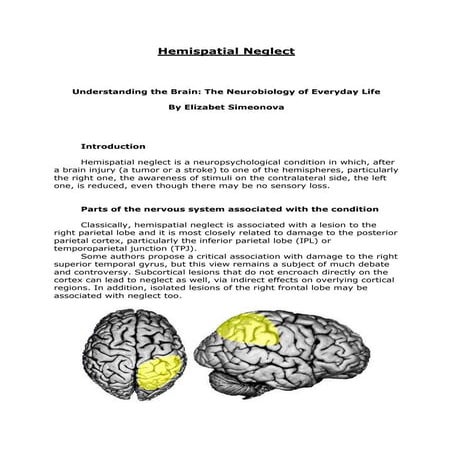 Project hemispatial neglect