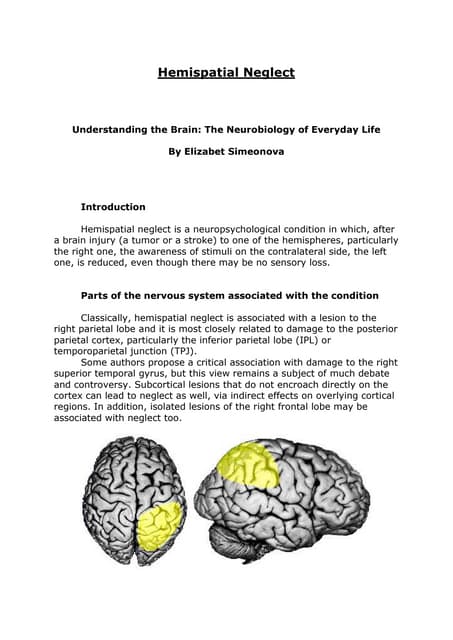 temporal lobe syndrome.pdf