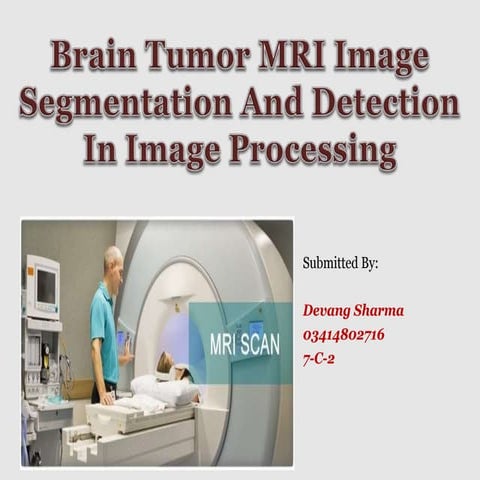 brain tumor detection project for MCA students