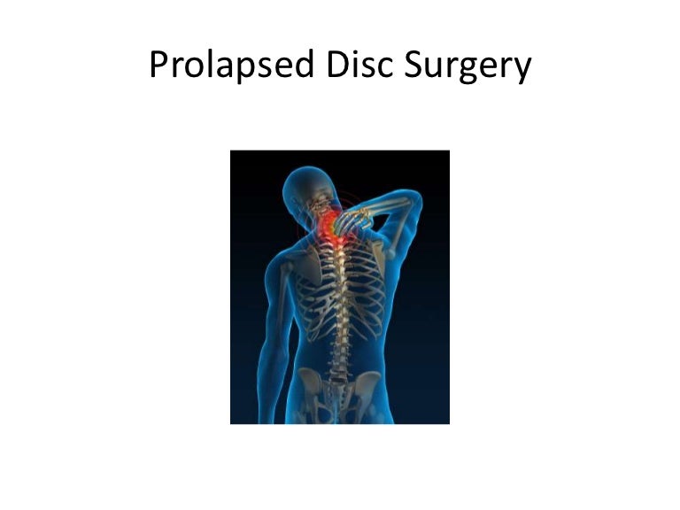Prolapsed Disc Surgery