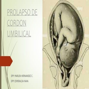 Protector económico de funda protectora de manguera en piral, Precio bajo Prot