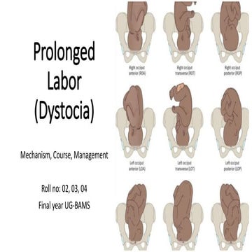 Comprehensive Overview of Prolonged Labor: Mechanism, Stages, and ...