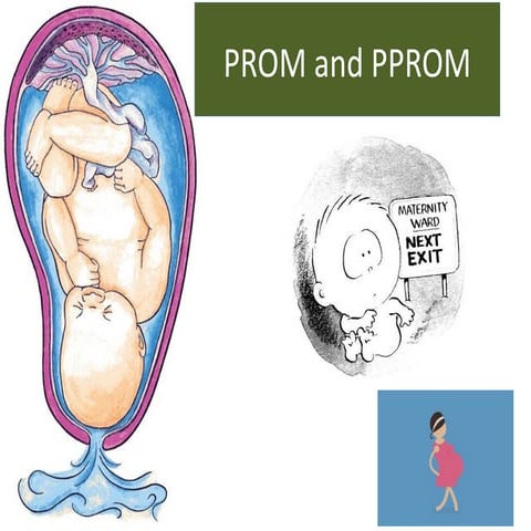 Premature rupture of membranes (PROM) | PPTX