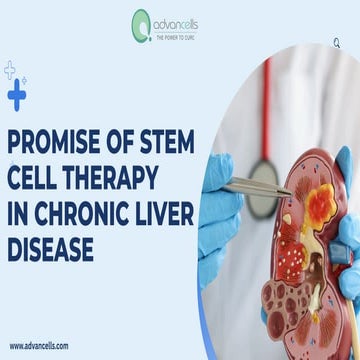 Promise of Stem Cell Therapy in Chronic Liver Disease.pdf