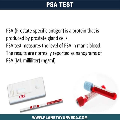 Prostate - Foods That Reduce PSA