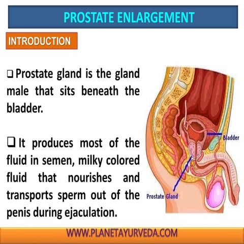 Prostate - Presentation
