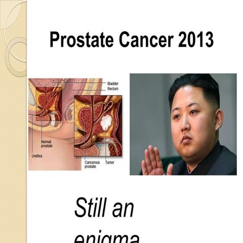 Prostate Cancer 2013