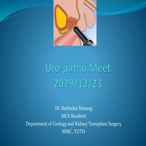 Prostate Biopsy (PBx).pptx