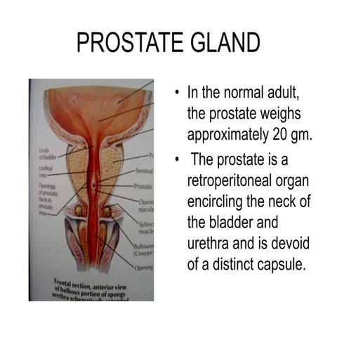 Pathology of prostate | PPT